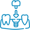 ceramic dental implants